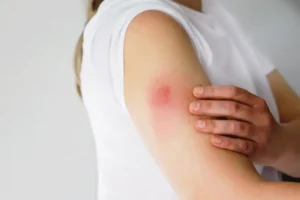 Palestra sobre reações alérgicas às vacinas no 42º Congresso Brasileiro de Pediatria