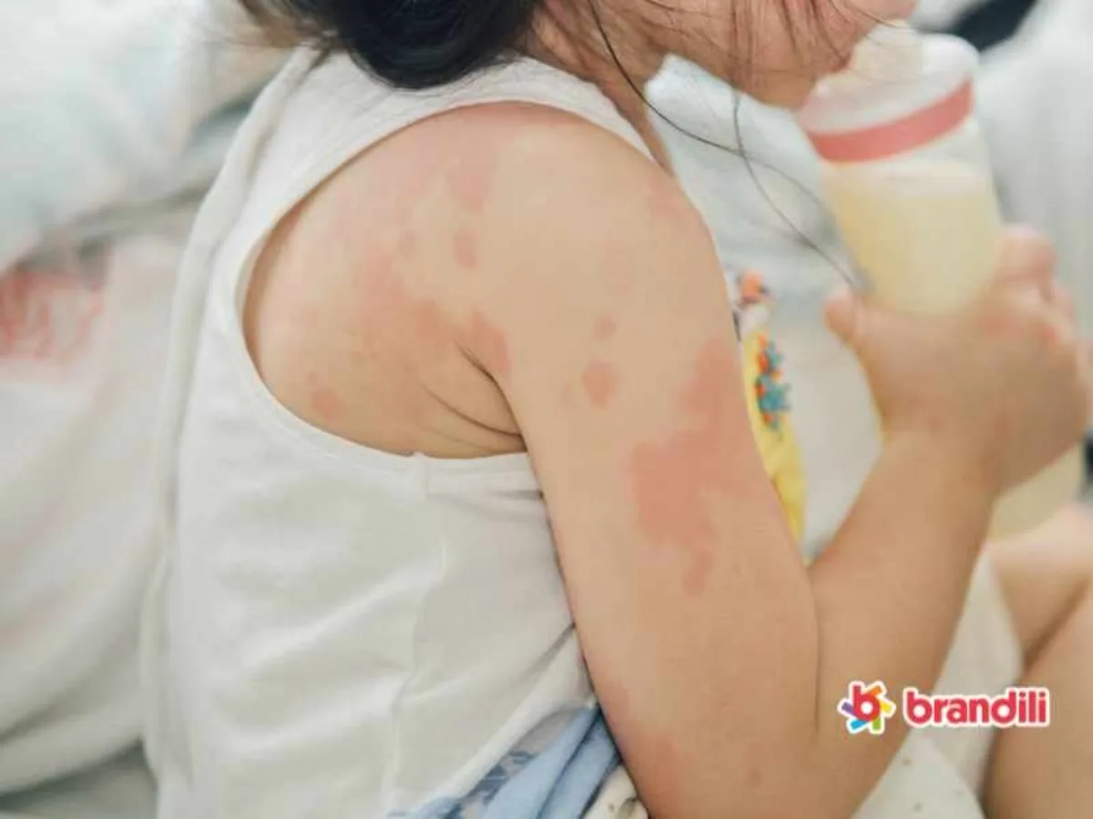 Palestra sobre alergia a medicamentos na criança no 42º Congresso Brasileiro de Pediatria