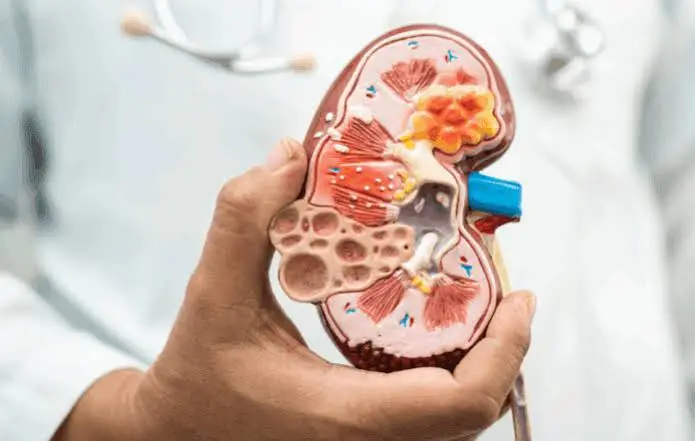 Ilustração médica sobre o diagnóstico e conduta na síndrome nefrótica esteroide sensível pediátrica segundo as diretrizes IPNA.