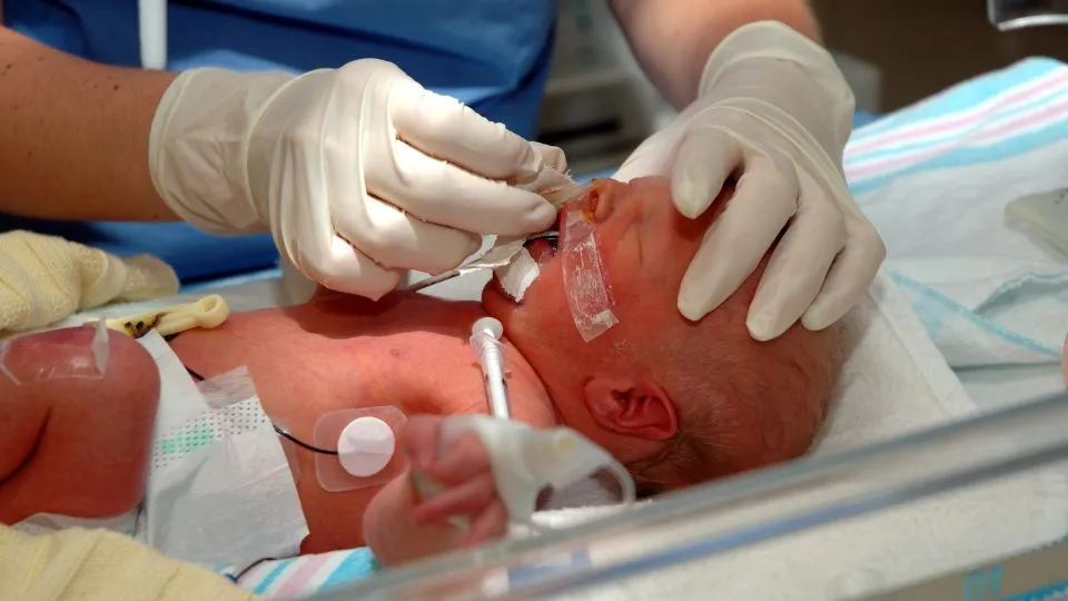 Equipe multiprofissional realizando reanimação neonatal e ventilação com pressão positiva em recém-nascido em sala de parto