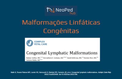 Malformações Linfáticas Congênitas